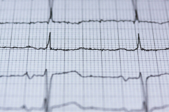 ecg-2270728_1920-1